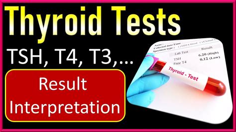 Understanding Your Thyroid Test Results: TSH, T4, T3, and More